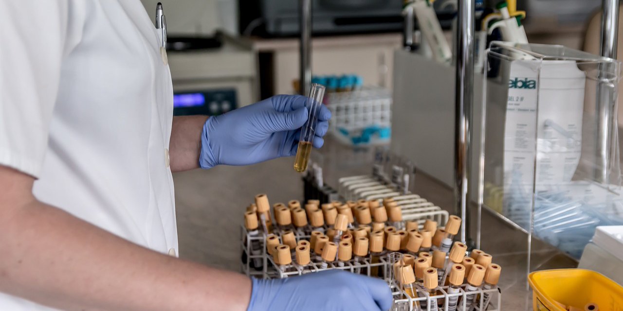 Если испытания будут успешными — вакцину против коронавируса можно будет испытывать на людях летом (Фото: jarmoluk/pixabay.com)