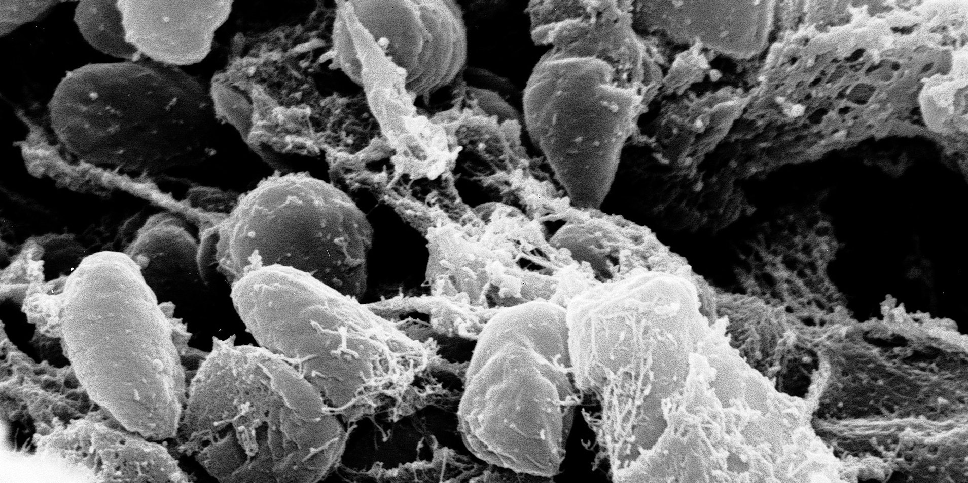 Микроснимок бактерии Yersinia pestis, которая является возбудителем чумы (Фото: NIAID via Flickr)