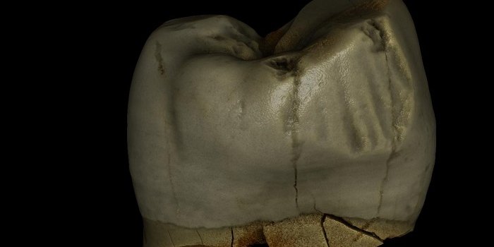 Трещина в зубе была оставлена зубочисткой (Фото: Dr. Marcin Binkowski from the University of Silesia)