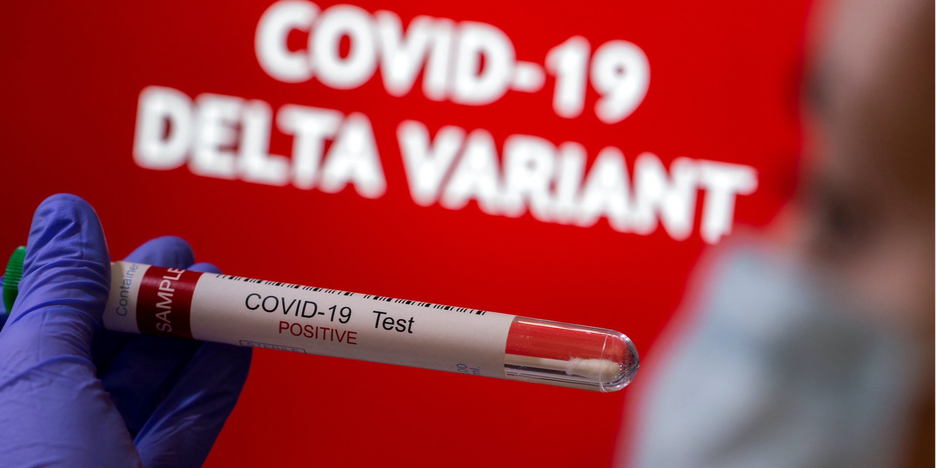 Концентрація Дельта-штаму COVID-19 в організмі в тисячі разів більше, ніж інших штамів (Фото: REUTERS/Dado Ruvic)