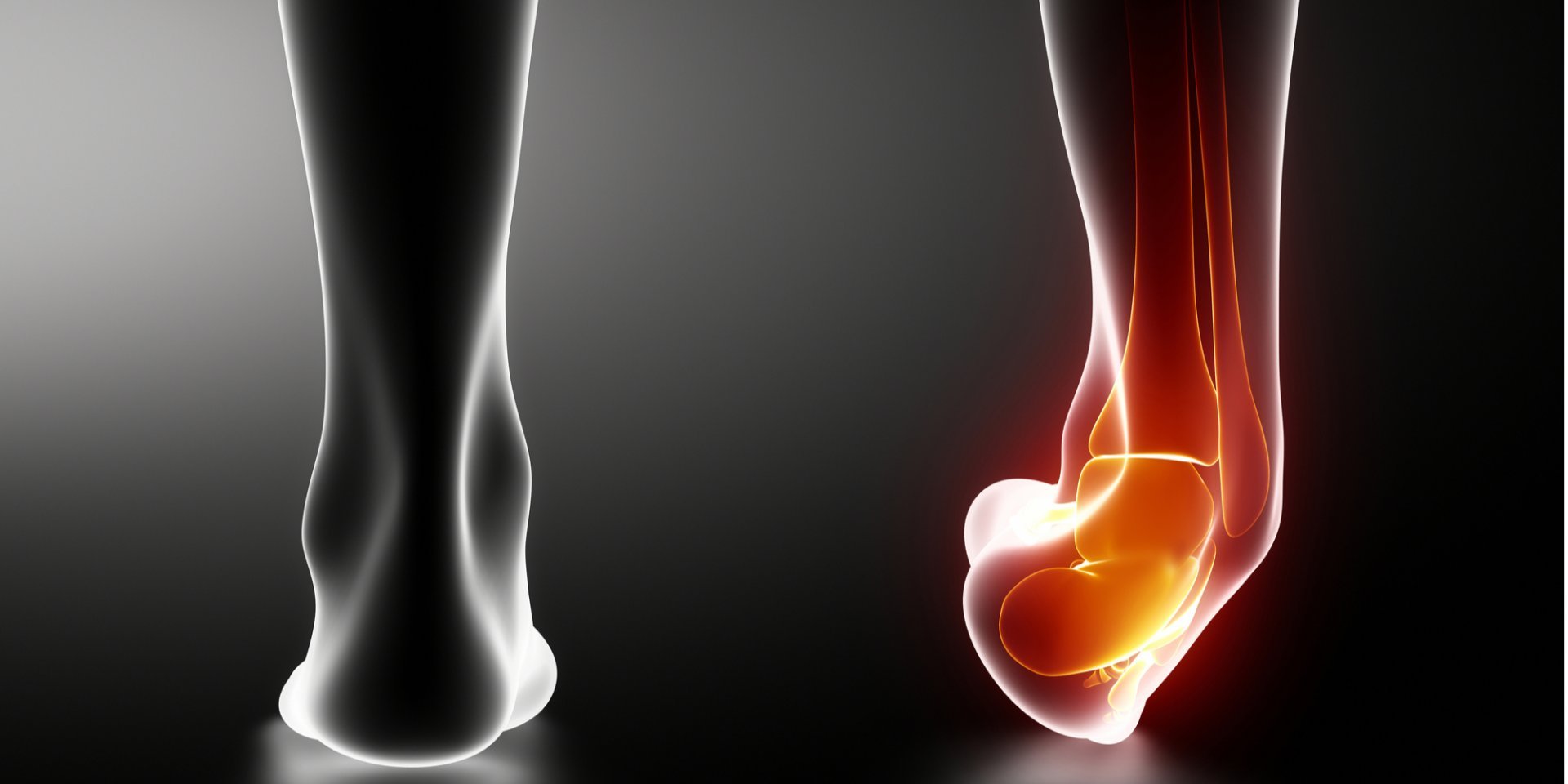 Сильне підвертання ноги: що робити і як надати першу допомогу?