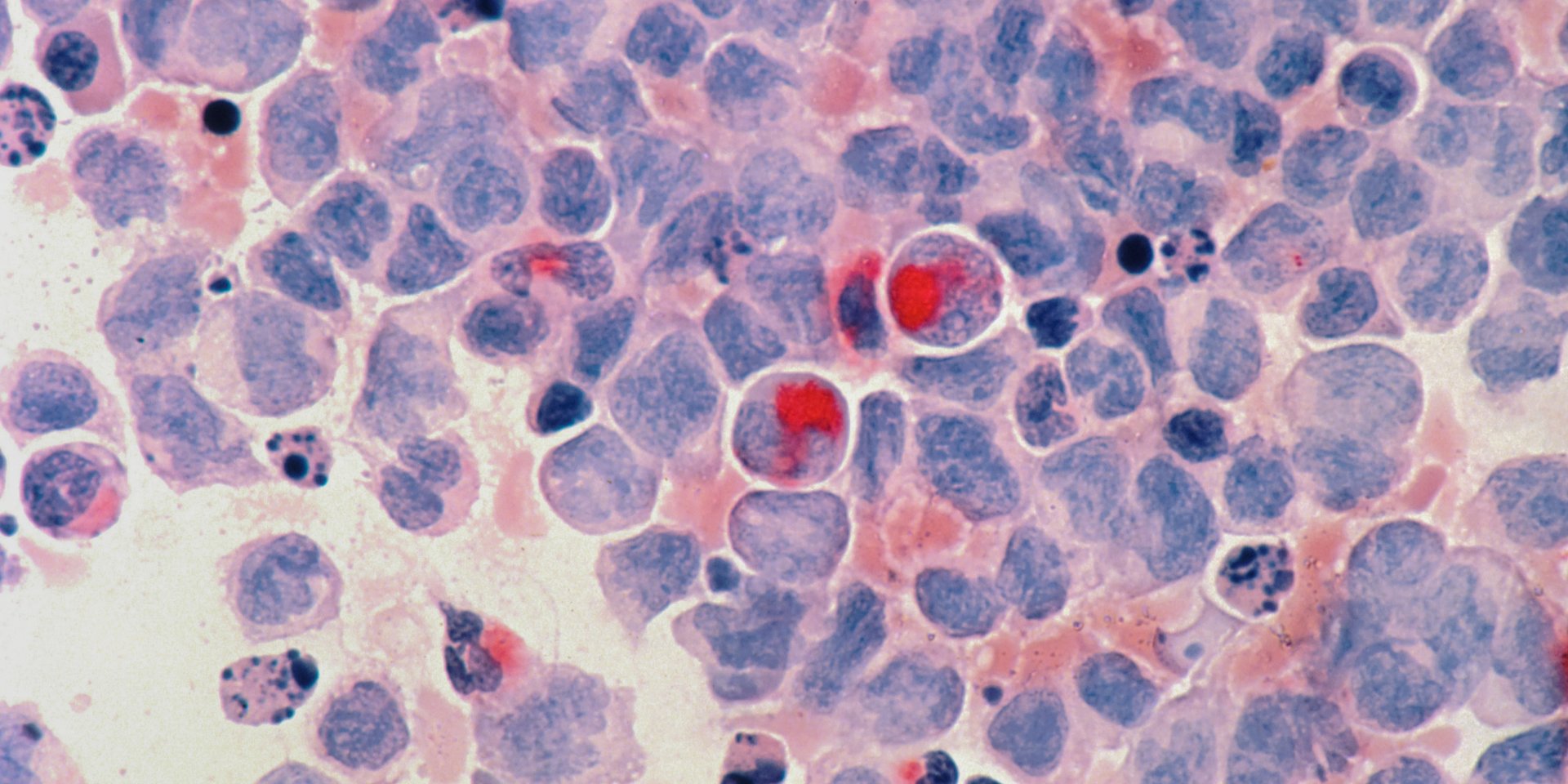 Рецептор CD95 можно использовать в новых терапевтических средств (Фото: National Cancer Institute)