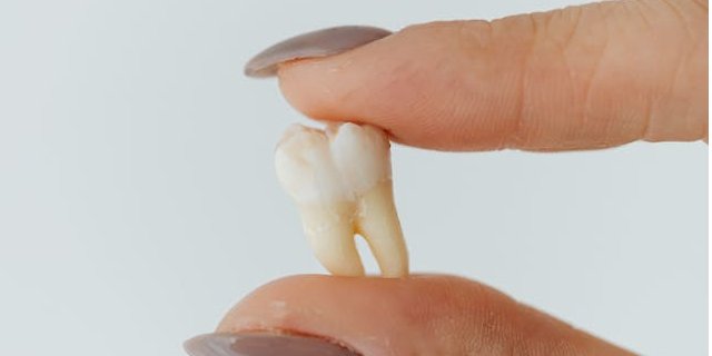 Сны о выпавших зубах не пророчат скорую смерть (Фото: pexels)