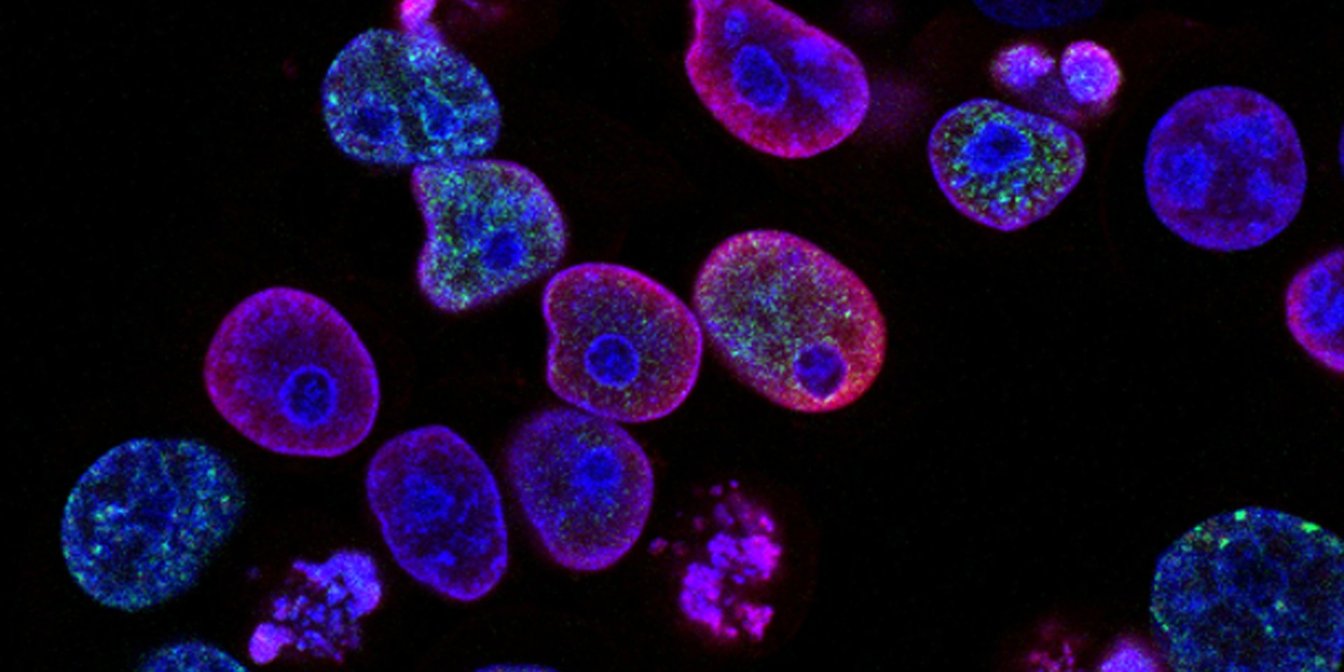 Ризик виникнення раку можна знизити скорегувавши свій стиль життя (Фото: National Cancer Institute/Unsplash)