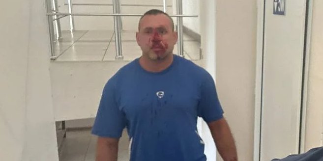 Начальник Одеського ТЦК розповів, де зараз фітнес-тренер, який образив військового (Фото: @Одеса INFO)