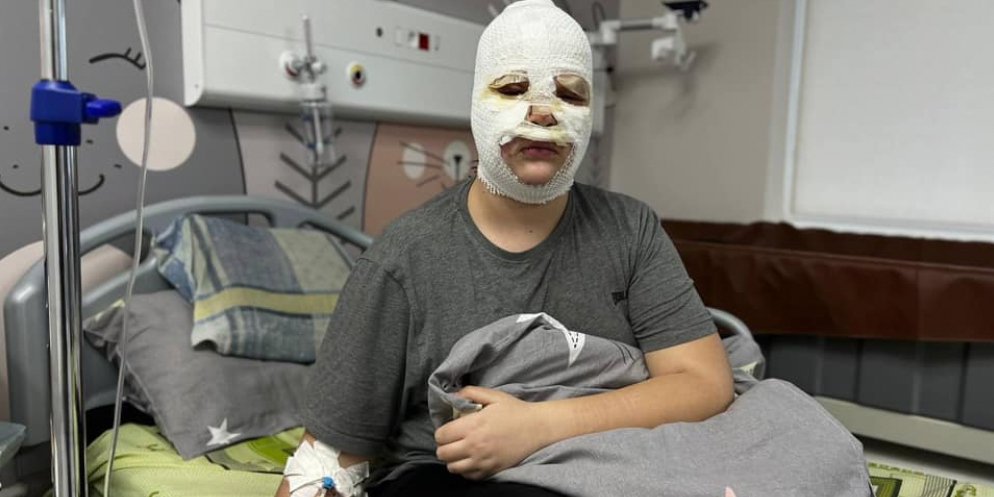 В’ячеслав виготовляв петарду за відеоінструкцією (Фото: Facebook Перше медичне об'єднання Львова)