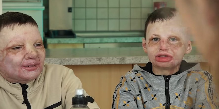 Юрій та Євген хочуть повернутися в Україну та сумують за друзями (Фото: Суспільне Івано-Франківськ)