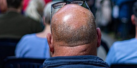 Ученые отмечают, что у людей с толстой шеей чаще развиваются гипертония, сердечная недостаточность и аритмии (Фото: pixabay)