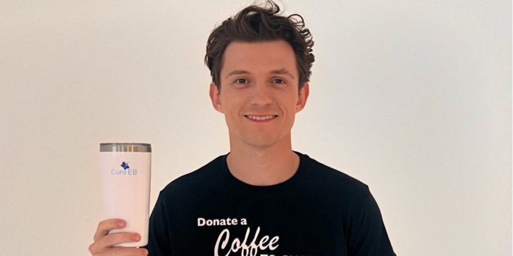 Том Голланд травмувався на зйомках фільму Людина-павук (Фото: tomholland2013/Instagram)