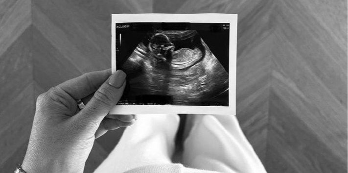 Женщина показала реакцию нерожденного ребенка на ее смех (Фото: manusiillv/Pinterest)