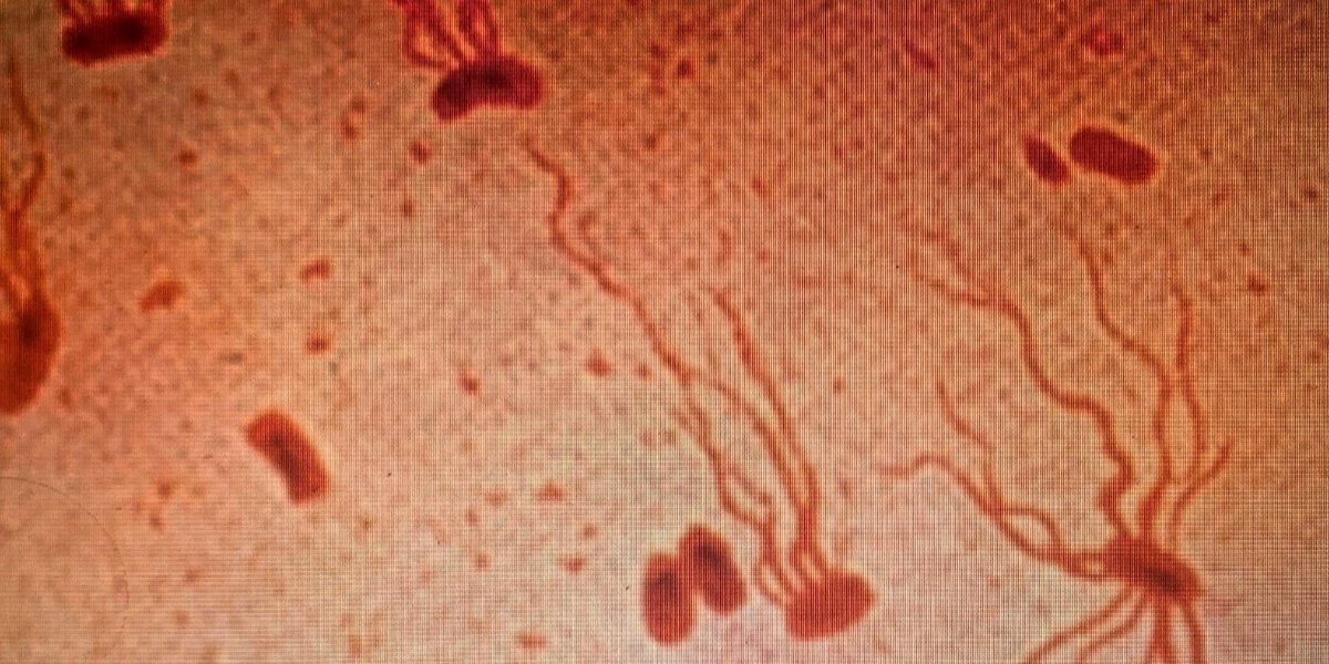 Salmonella enterica S. Typhi. (Фото: Microbewriter/Wikimedia Commons/CC BY SA 4.0)