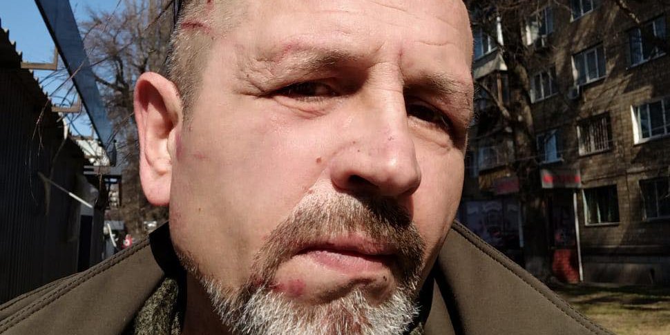 Нардеп повідомив, що в приміщенні столичного ТЦК побили ветерана Балуха. Поліція перевіряє інформацію