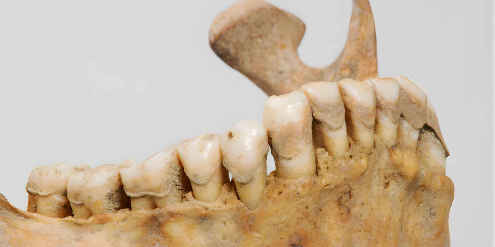 «Энергетики» бронзового века. В зубах женщины возрастом 4000 лет нашли следы психоактивных веществ