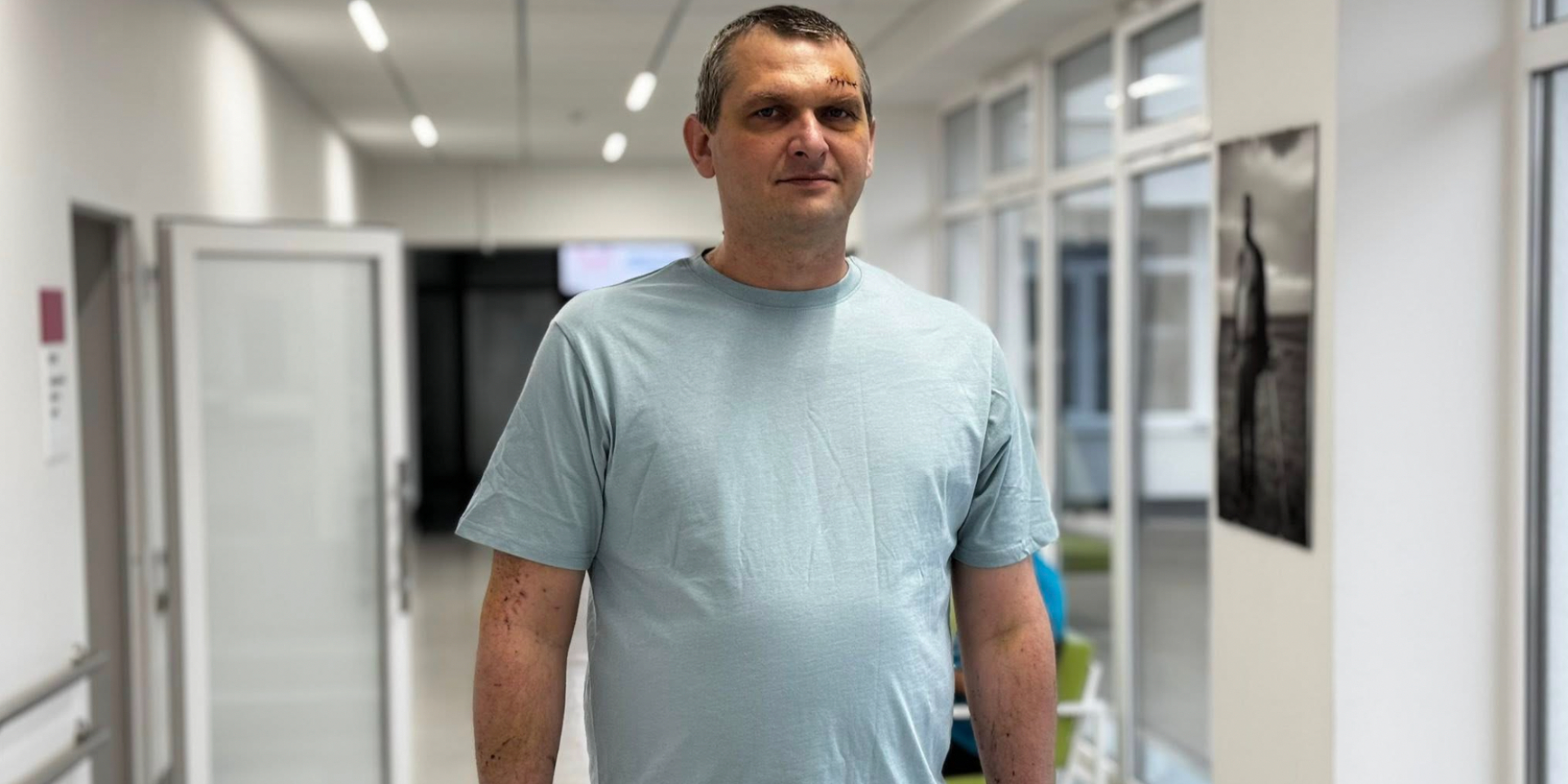 Вышел на балкон посмотреть на шахед. У львовянина обнаружили 10-сантиметровый кусок стекла в легком после атаки РФ