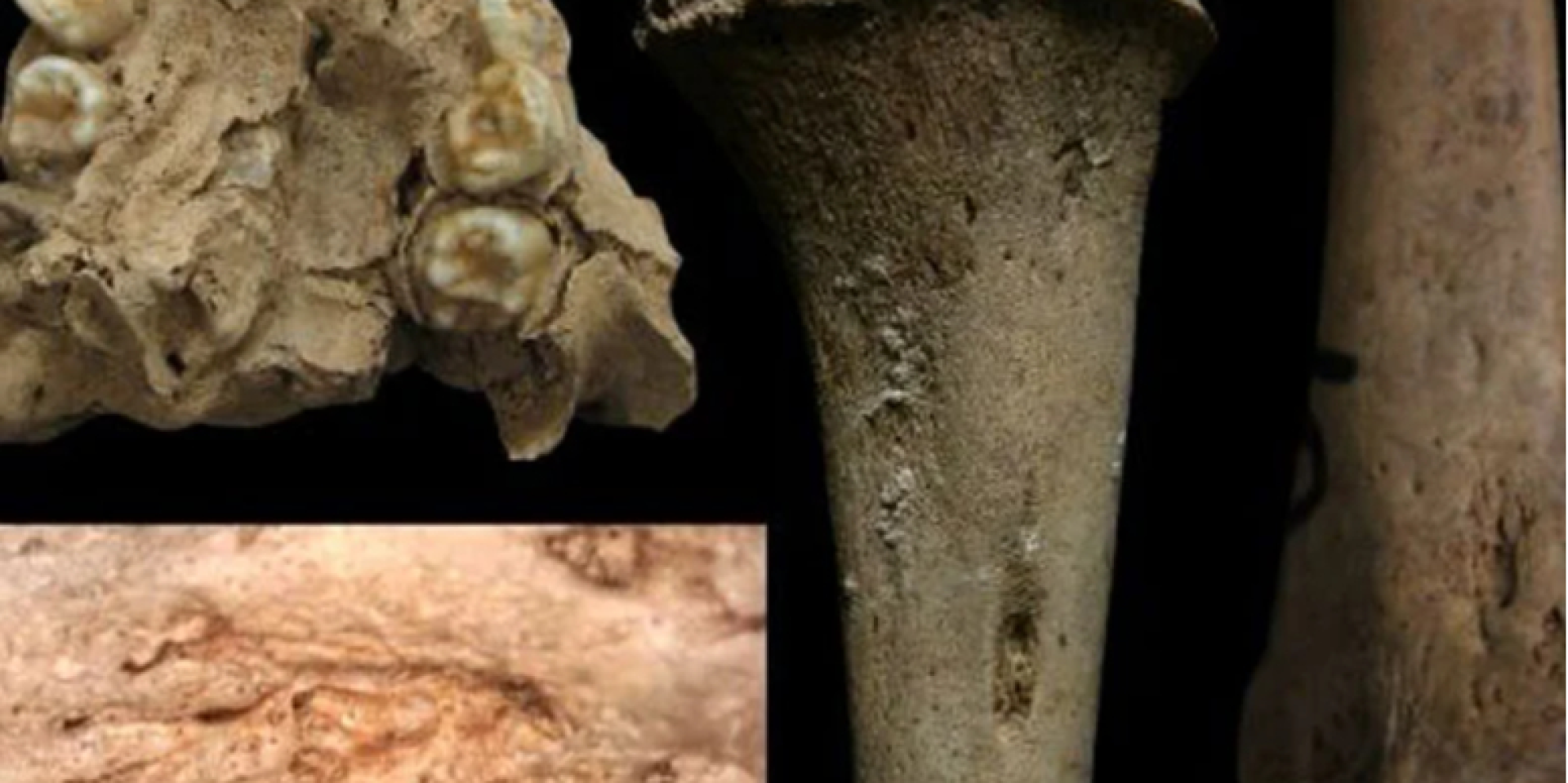 Поиск древней ДНК в тропиках. Скелеты из Вьетнама заставили пересмотреть историю сифилиса