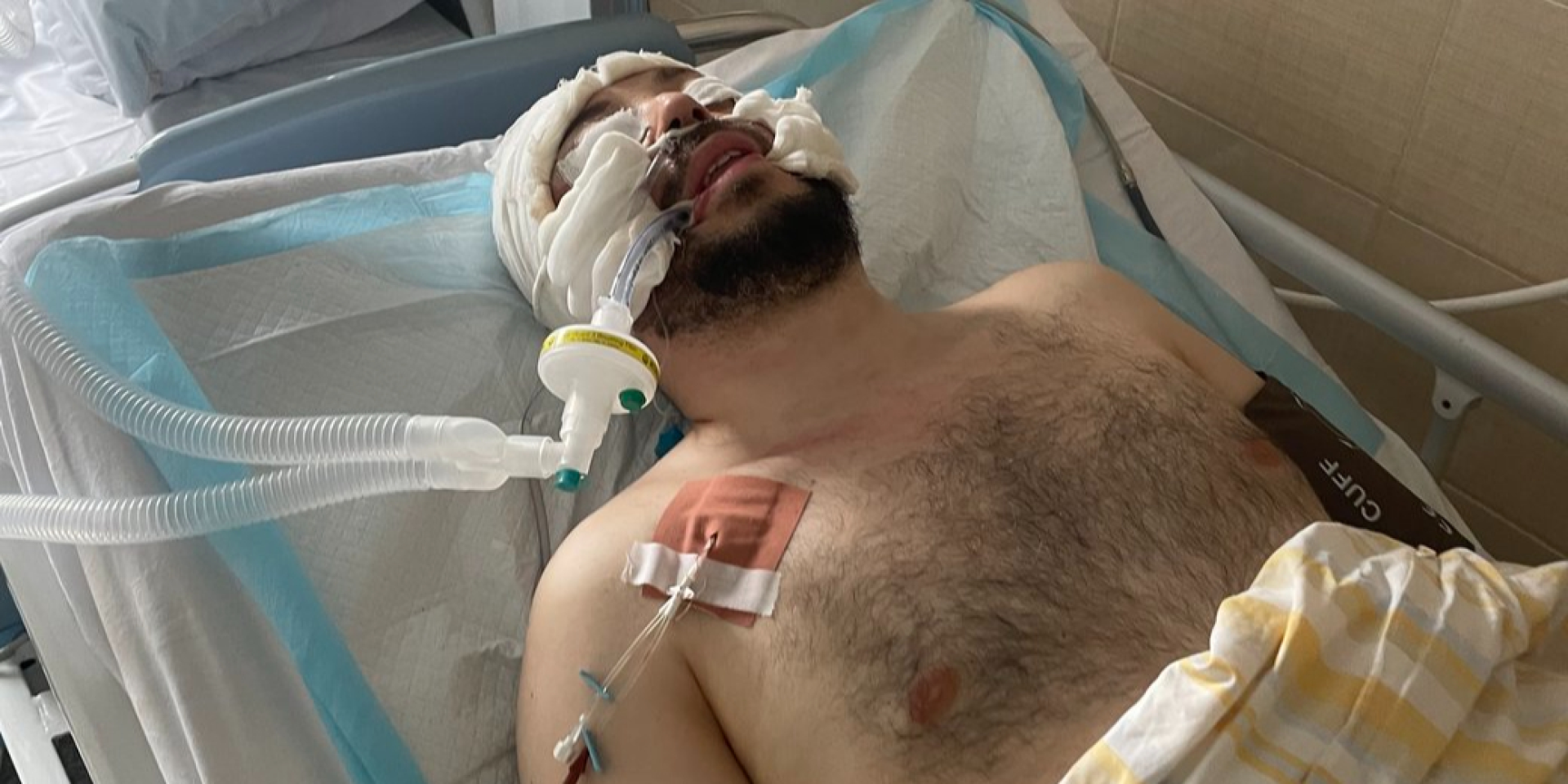 «Убегал и упал, ударившись головой». В Днепропетровском ТЦК отрицают насилие в отношении мужчины, который теперь находится в коме