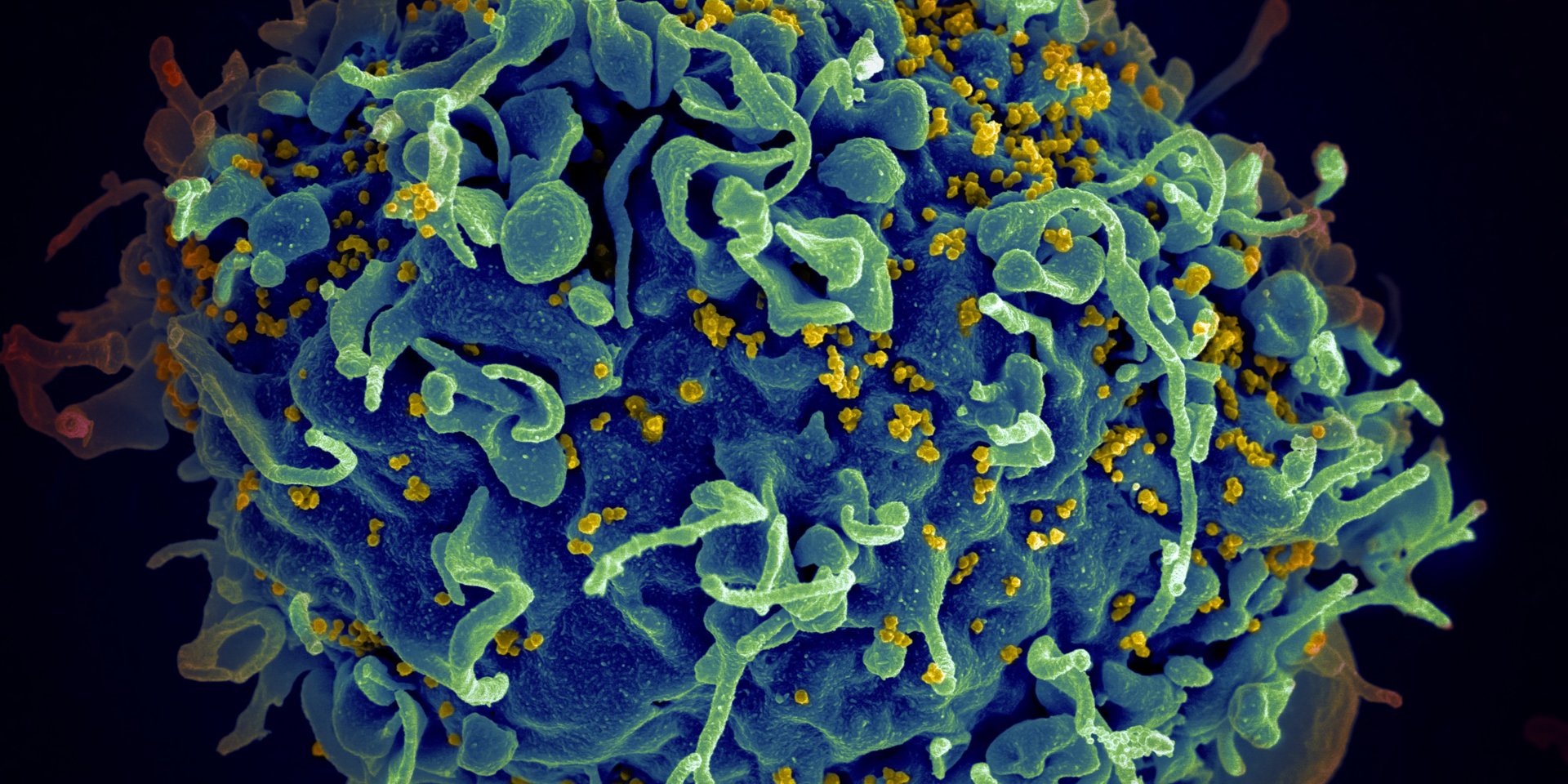 Мозговая активность участников эксперимента стала более разнообразной и менее шаблонной (Фото: National Cancer Institute/Unsplash)