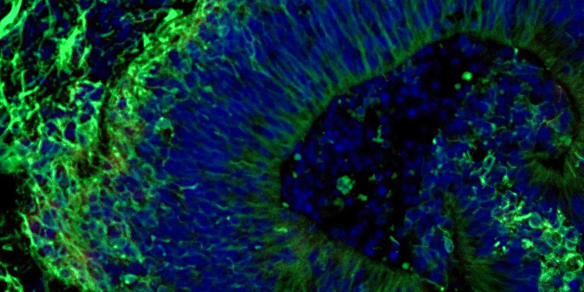 Флуоресцентное изображение органоида мозга (Фото: Machairaki lab)
