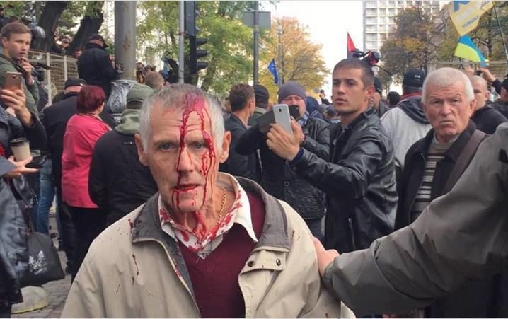 Митинг не обошелся без инцидентов (Фото: Фото: Galya Plachynda / Facebook)