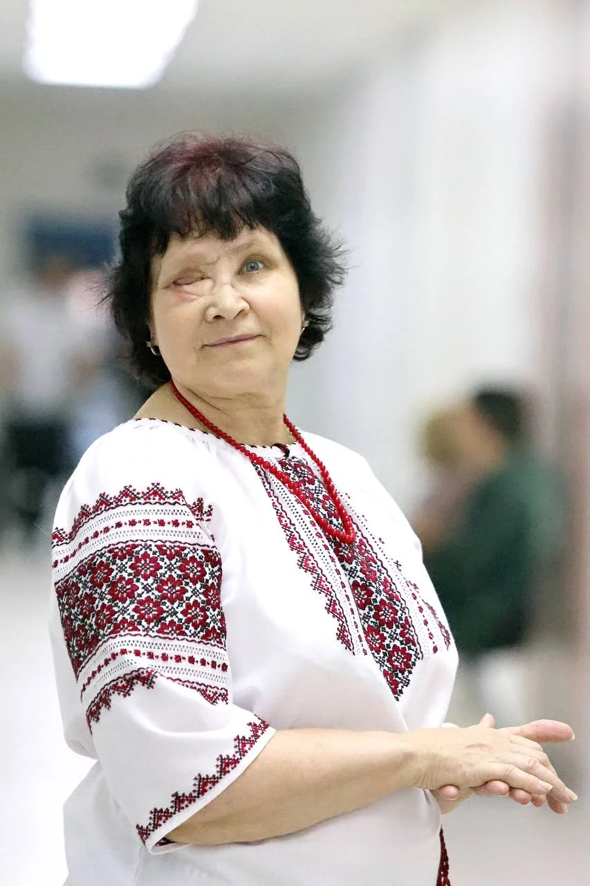 Елена Светлова, пациентка проекта «Незламна краса» (Фото: Центр Unbroken)