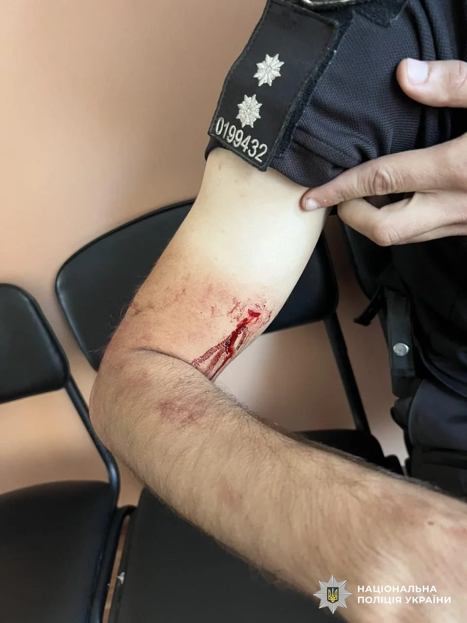 Національна поліція України / Facebook