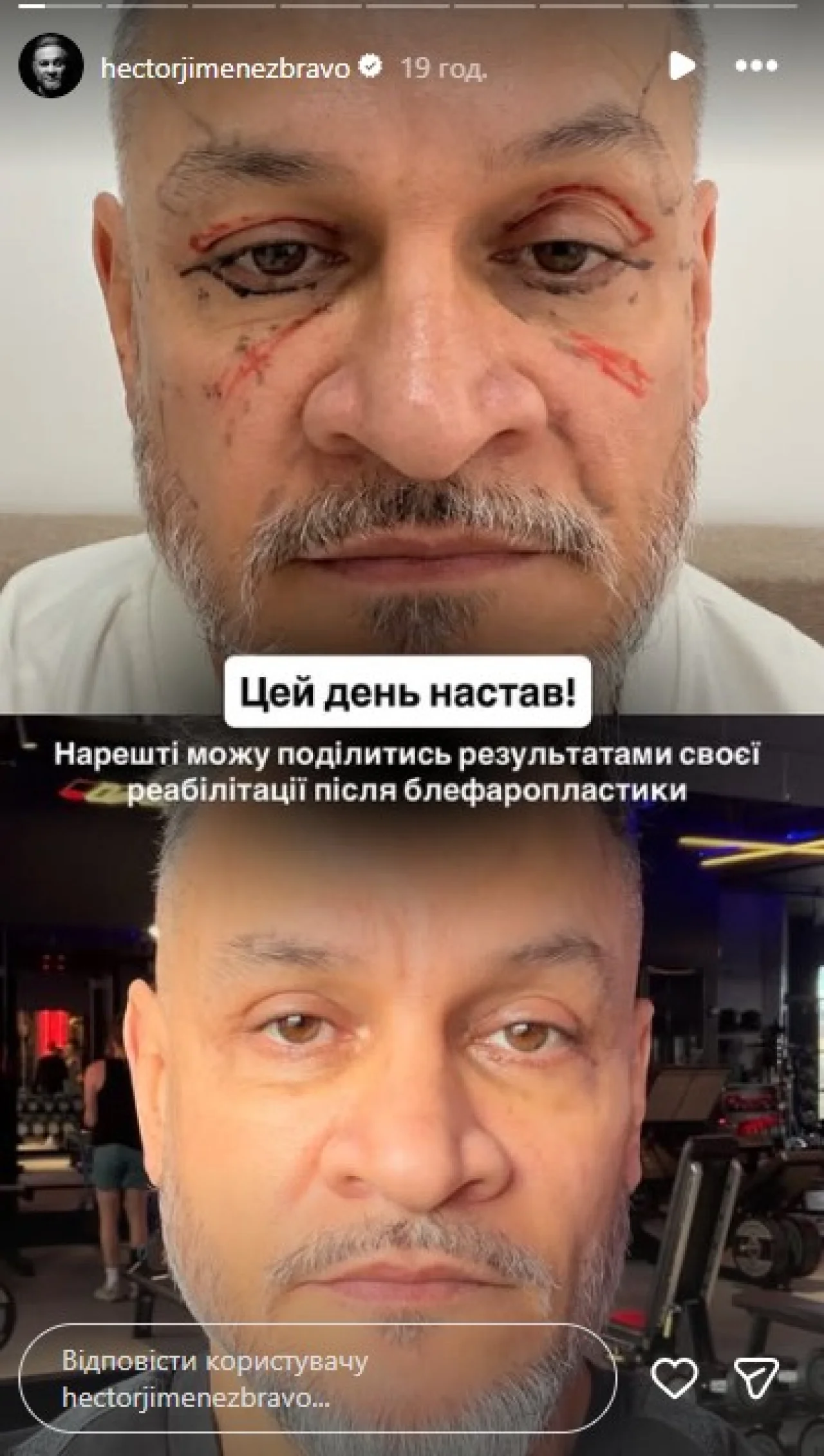 Эктор Хименес-Браво впервые после пластики показал  результат (Фото: instagram.com/hectorjimenezbravo)